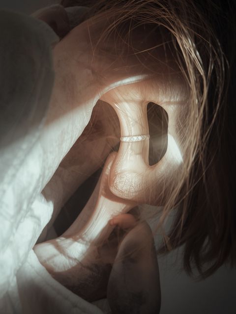 Inflammation of the Hip Joint Capsule