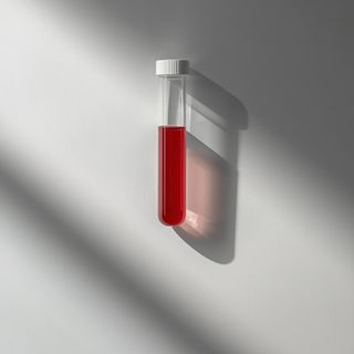 "Blood glucose concentration – indicators of excessive hyperglycemia. Approaches to counteracting rising blood sugar levels"